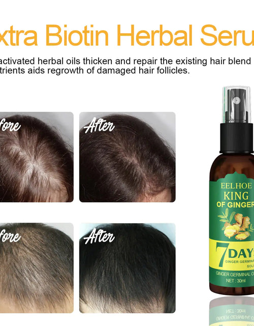 Load image into Gallery viewer, Ginger Hair Growth Serum Sprayer Hair Regrowth
