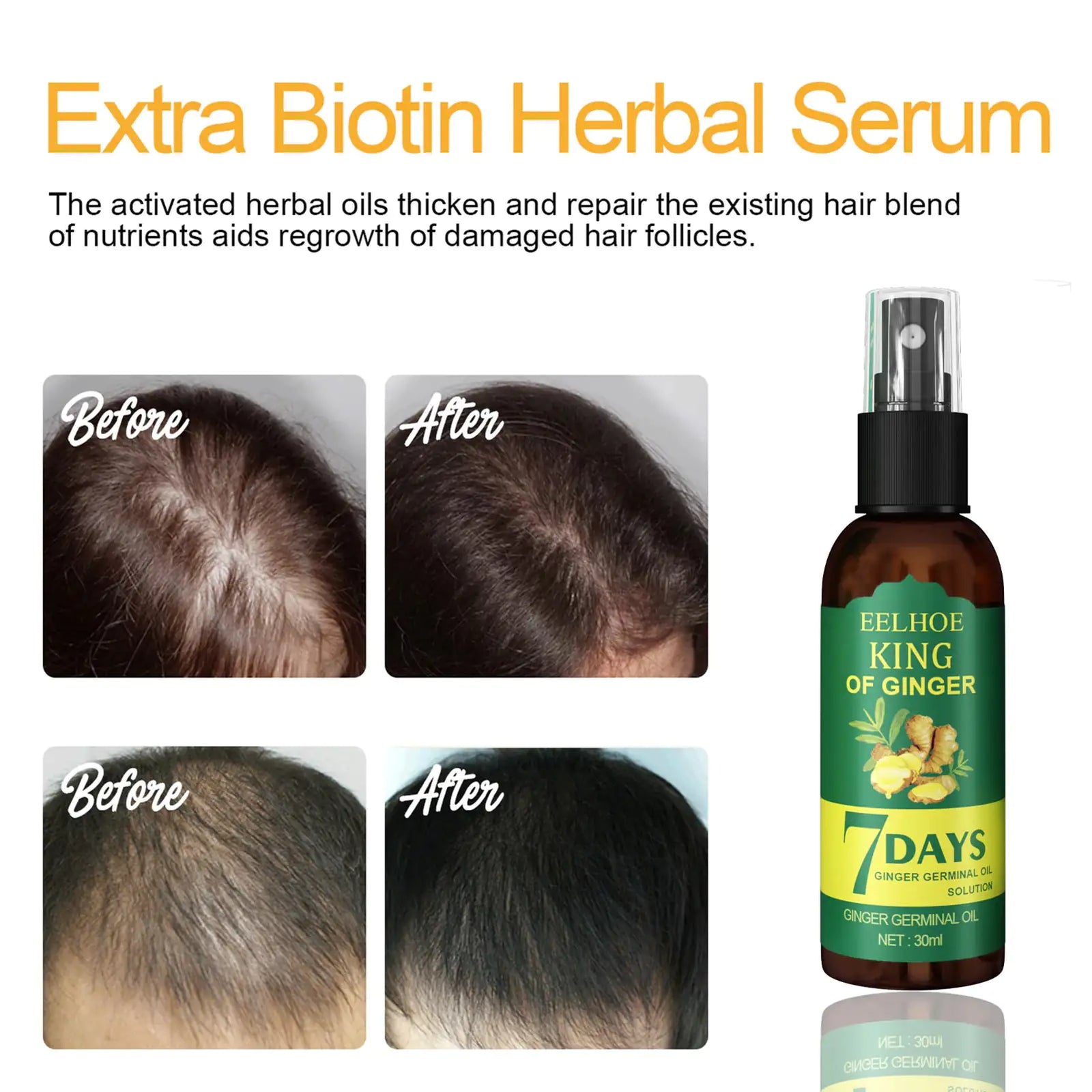 Ginger Hair Growth Serum Sprayer Hair Regrowth