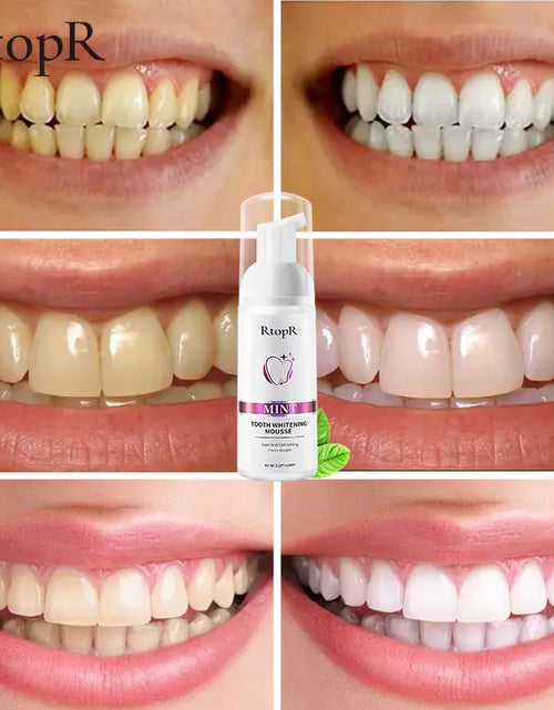 Load image into Gallery viewer, Tooth Whitening Mousse
