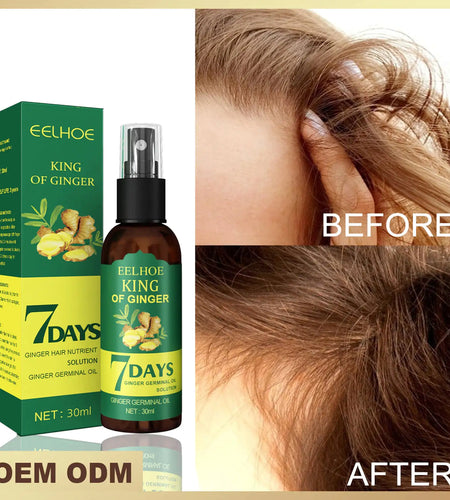 Ginger Hair Growth Serum Sprayer Hair Regrowth