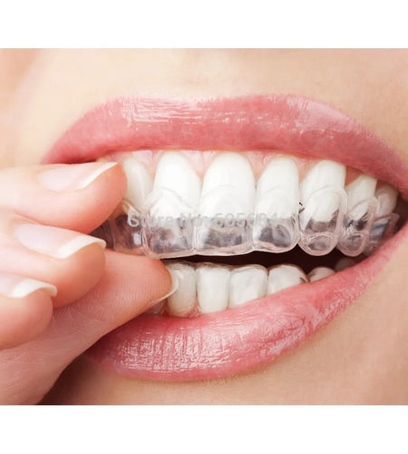 Ogreen Teeth Whitening Kit