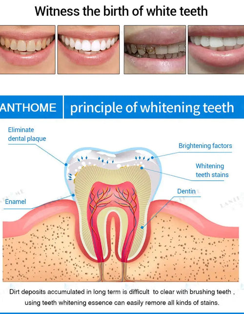 Load image into Gallery viewer, Teeth Whitening Pen
