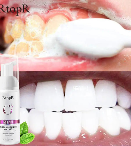 Tooth Whitening Mousse