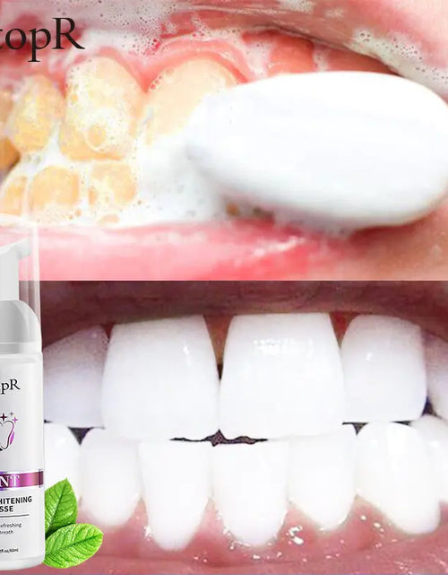 Load image into Gallery viewer, Tooth Whitening Mousse
