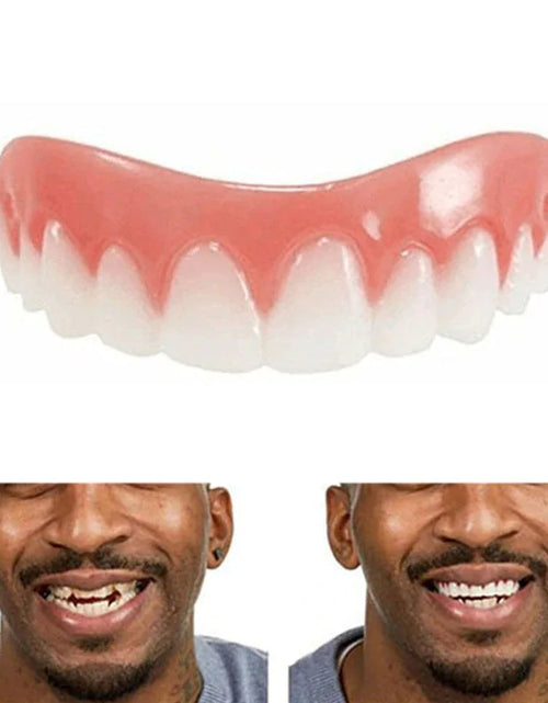 Load image into Gallery viewer, Teeth Whitening Dentures
