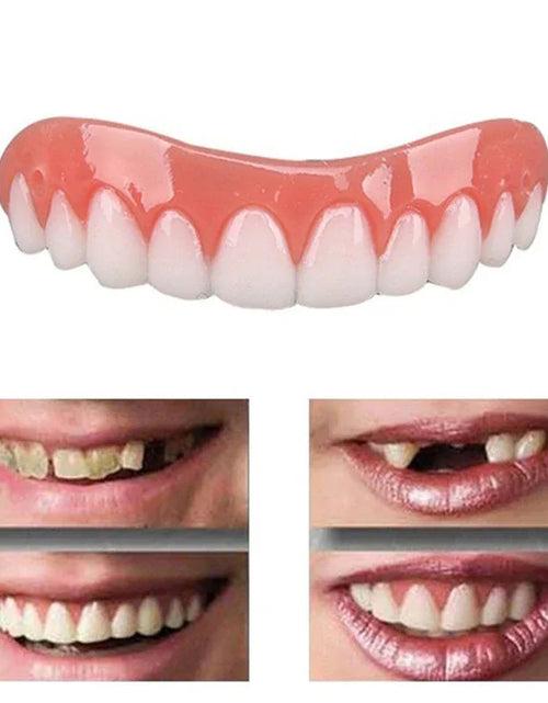 Load image into Gallery viewer, Teeth Whitening Dentures
