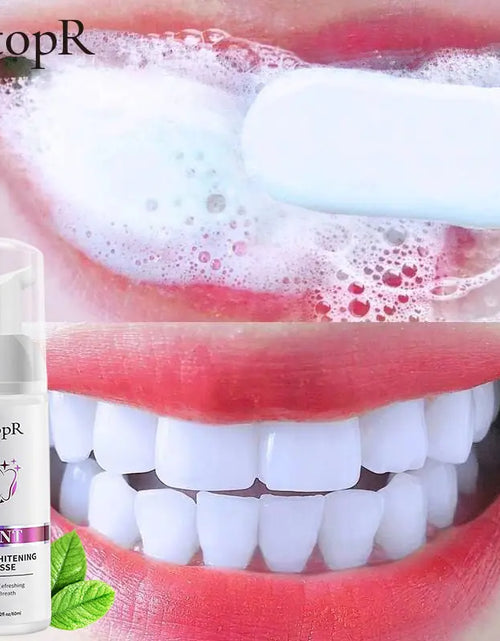 Load image into Gallery viewer, Tooth Whitening Mousse
