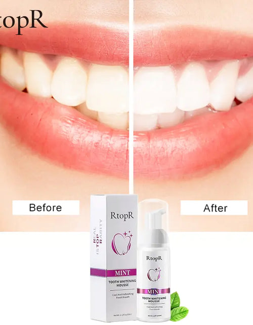 Load image into Gallery viewer, Tooth Whitening Mousse
